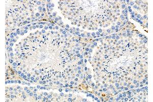 ABIN6264417 and ABIN6276284 at 1/100 staining Mouse testis tissue by IHC-P.
