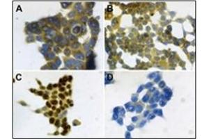 Immunohistochemistry (IHC) image for anti-S100 Calcium Binding Protein A7 (S100A7) antibody (ABIN400722) (S100A7 抗体)