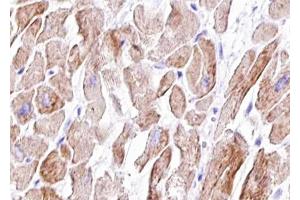 ABIN6267417 at 1/100 staining human Heart muscle tissue sections by IHC-P. (Vinculin 抗体  (pTyr822))