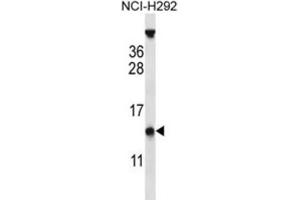 Western Blotting (WB) image for anti-PYD (Pyrin Domain) Containing 1 (PYDC1) antibody (ABIN2997157) (PYDC1 抗体)