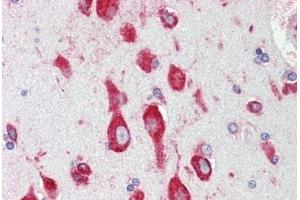 Human Brain, Cortex: Formalin-Fixed, Paraffin-Embedded (FFPE) (RPS12 抗体  (AA 15-44))