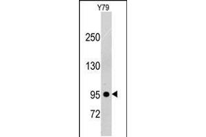 Western blot analysis of anti-PDGFRB Pab in Y79 cell line lysates (35ug/lane). (PDGFRB 抗体)