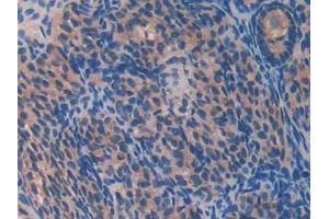 DAB staining on IHC-P; Samples: Mouse Ovary Tissue (PON2 抗体  (AA 4-289))