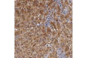 Immunohistochemical staining of human liver with ZNF229 polyclonal antibody  shows cytoplasmic positivity in hepatocytes at 1:50-1:200 dilution.