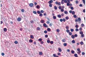 Human Brain, Cerebellum (formalin-fixed, paraffin-embedded) stained with ENO2 antibody ABIN364284 at 20 ug/ml followed by biotinylated anti-mouse IgG secondary antibody ABIN481714, alkaline phosphatase-streptavidin and chromogen. (ENO2/NSE 抗体)
