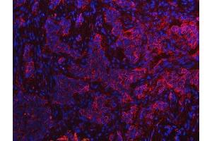 IF analysis of S100A10 using anti-S100A10 antibody (ABIN5692833). (S100A10 抗体  (AA 4-94))