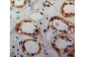 Used in DAB staining on fromalin fixed paraffin-embedded Kidney tissue (BMPR2 抗体  (AA 27-150))