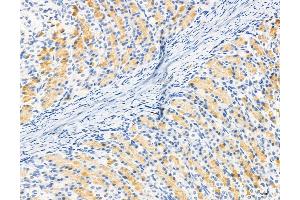 ABIN6264119 and ABIN6272974 at 1/100 staining Rat stomach tissue by IHC-P. (PDLIM7 抗体  (N-Term))