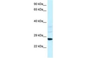 Image no. 1 for anti-Vacuolar-sorting Protein SNF8 (SNF8) (AA 25-74) antibody (ABIN6747424) (SNF8 抗体  (AA 25-74))