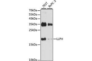 Western blot analysis of extracts of various cell lines, using LLPH antibody (ABIN7268290) at 1:1000 dilution. (LLPH 抗体  (AA 1-129))