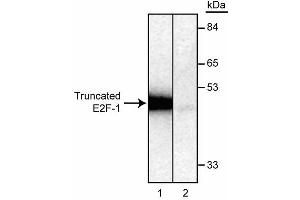 Detection of in vitro translated, [35S] methionine-labeled, truncated E2F-1 protein by immunoprecipitation using KH95/E2F (ABIN967439). (E2F1 抗体)