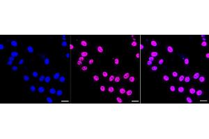 Immunocytochemical staining of HepG2 cells with Phospho-mTOR (S) antibody (ABIN7799349), 1:1,000). (Recombinant MTOR 抗体  (pSer2481))