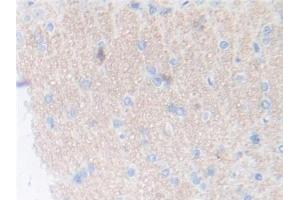 IHC-P analysis of Rat Cerebrum Tissue, with DAB staining. (Thrombopoietin 抗体  (AA 24-266))