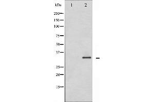 Western blot analysis of Caspase 3 phosphorylation expression in Etoposide treated Jurkat whole cell lysates,The lane on the left is treated with the antigen-specific peptide. (Caspase 3 抗体  (pSer150))