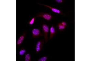 Immunofluorescence (IF) image for anti-Small Ubiquitin Related Modifier 2 (SUMO2) (AA 1-93), (N-Term) antibody (ABIN492386) (SUMO2 抗体  (N-Term))