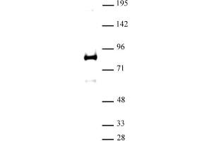 XRCC1 antibody (pAb) tested by Western blot. (XRCC1 抗体  (N-Term))