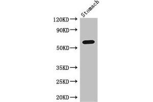 Western Blot Positive WB detected in: Mouse stomach tissue All lanes: IL4I1 antibody at 3 μg/mL Secondary Goat polyclonal to rabbit IgG at 1/50000 dilution Predicted band size: 63, 66 kDa Observed band size: 63 kDa (IL4I1 抗体  (AA 139-339))