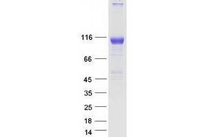 Western Blotting (WB) image for EPH Receptor A7 (EPHA7) protein (Myc-DYKDDDDK Tag) (ABIN2720241)
