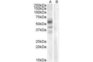 ABIN263179 (0. (Arylsulfatase D 抗体  (Internal Region))