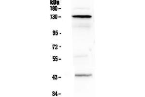 Western blot analysis of VE Cadherin using anti-VE Cadherin antibody . (Cadherin 5 抗体  (AA 48-272))
