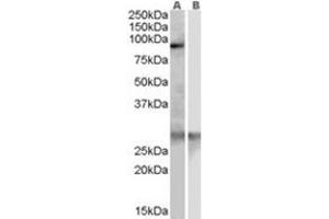 Image no. 1 for anti-Acetyl LDL Receptor (SCARF1) (Internal Region) antibody (ABIN374467) (SCARF1 抗体  (Internal Region))