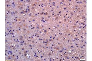 Formalin-fixed and paraffin embedded rat brain labeled with Anti-LDOC1/BCUR1 Polyclonal Antibody, Unconjugated (ABIN717836) at 1:200 followed by conjugation to the secondary antibody and DAB staining (LDOC1 抗体  (AA 65-146))