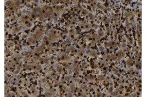 ABIN6279817 at 1/100 staining Human liver tissue by IHC-P. (SH3BGRL 抗体  (Internal Region))