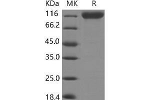 Western Blotting (WB) image for Myelin Associated Glycoprotein (MAG) protein (Fc Tag,ECD) (ABIN7197064) (MAG Protein (Fc Tag,ECD))