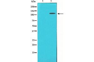 Western blot analysis of CD130/gp130 expression in Jurkat whole cell lysates,The lane on the left is treated with the antigen-specific peptide. (CD130/gp130 抗体  (C-Term))