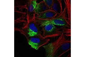 Immunofluorescence analysis of Hela cells using ZEB1 mouse mAb (green). (ZEB1 抗体  (AA 967-1108))