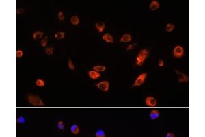 Immunofluorescence analysis of L929 cells using ARL13B Polyclonal Antibody at dilution of 1:100. (ARL13B 抗体)