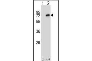 Western blot analysis of Nek8 (arrow) using rabbit polyclonal Mouse Nek8 Antibody (C-term) (ABIN657848 and ABIN2846809). (NEK8 抗体  (C-Term))