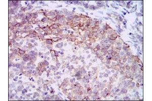 Image no. 1 for anti-Hyaluronan Synthase 3 (HAS3) (AA 312-364) antibody (ABIN1498588) (HAS3 抗体  (AA 312-364))