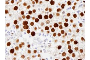 anti-Minichromosome Maintenance Complex Component 2 (MCM2) (pSer108) antibody