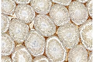 ABIN6265713 and ABIN6272897 at 1/100 staining Rat testis tissue by IHC-P.