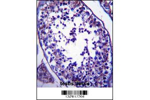 SLC27A3 Antibody immunohistochemistry analysis in formalin fixed and paraffin embedded human testis tissue followed by peroxidase conjugation of the secondary antibody and DAB staining. (SLC27A3 抗体  (N-Term))