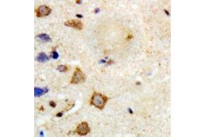 Immunohistochemical analysis of TRAF6 staining in human brain formalin fixed paraffin embedded tissue section. (TRAF6 抗体)