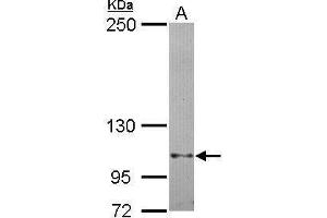 WB Image Sample (30 ug of whole cell lysate) A: Hela 5% SDS PAGE antibody diluted at 1:1000 (FAK 抗体  (C-Term))