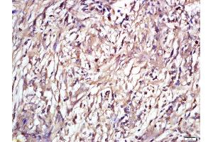 Immunohistochemistry (Paraffin-embedded Sections) (IHC (p)) image for anti-Solute Carrier Family 29 (Nucleoside Transporters), Member 2 (SLC29A2) (AA 221-320) antibody (ABIN2559658)