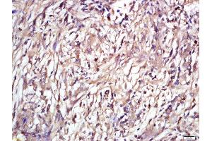 Formalin-fixed and paraffin embedded human laryngeal tissue labeled with Rabbit Anti-ENT2 Polyclonal Antibody, Unconjugated (ABIN2559658) at 1:200 followed by conjugation to the secondary antibody and DAB staining