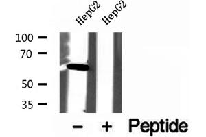 Western blot analysis of extracts of HepG2 cells, using USP39 antibody. (USP39 抗体  (N-Term))