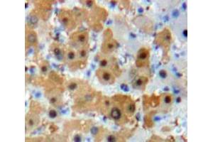 Used in DAB staining on fromalin fixed paraffin-embedded Liver tissue (FOXO1 抗体  (AA 222-469))