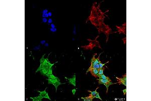 Immunocytochemistry/Immunofluorescence analysis using Mouse Anti-Ankyrin R Monoclonal Antibody, Clone S388A-10 . (Erythrocyte Ankyrin 抗体  (AA 1-1881) (Biotin))