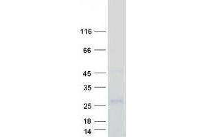 Western Blotting (WB) image for GRB2-Related Adaptor Protein (GRAP) protein (Myc-DYKDDDDK Tag) (ABIN2722222)