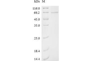 3-phosphoinositide Dependent Protein Kinase-1 (PDPK1) (AA 1-556), (full length) protein (His tag)