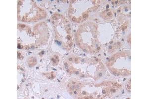 Used in DAB staining on fromalin fixed paraffin- embedded Kidney tissue (UMPS 抗体  (AA 205-480))