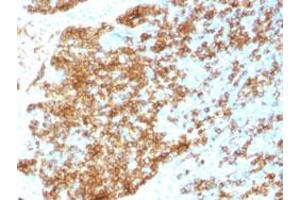 Immunohistochemical staining (Formalin-fixed paraffin-embedded sections) of human tonsil with CD45RB recombinant monoclonal antibody, clone PTPRC/1783R . (Recombinant CD45 抗体)