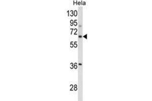 Western blot analysis of ITGBL1 Antibody (Center) in Hela cell line lysates (35ug/lane).