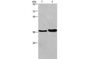 Western Blot analysis of Human testis tissue and transitional cell carcinoma of bladder tissue using FUT1 Polyclonal Antibody at dilution of 1:250 (FUT1 抗体)