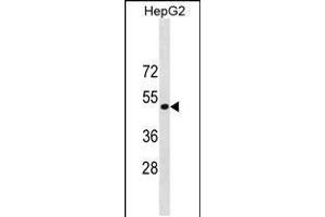 Western blot analysis in HepG2 cell line lysates (35ug/lane). (ST6GAL1 抗体  (AA 178-206))